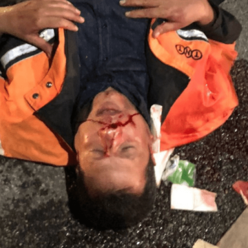 TNT-FedEx, lavoratori Si Cobas in protesta aggrediti da bodyguard privati: uno in ospedale a Pavia. La Questura: “15 giorni di prognosi”