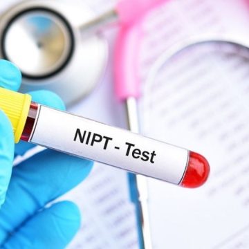 Dna fetale, al via la fase pilota in Lombardia: test gratuito e laboratorio unico al Policlinico