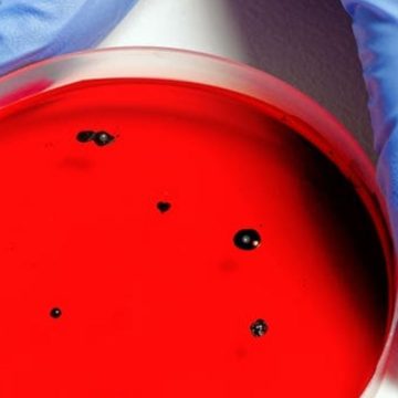 Variante Omicron Italia, mappa Variante Omicron Italia, mappa