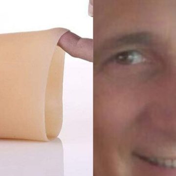 Chi è Guido Russo, il no vax con il braccio di silicone