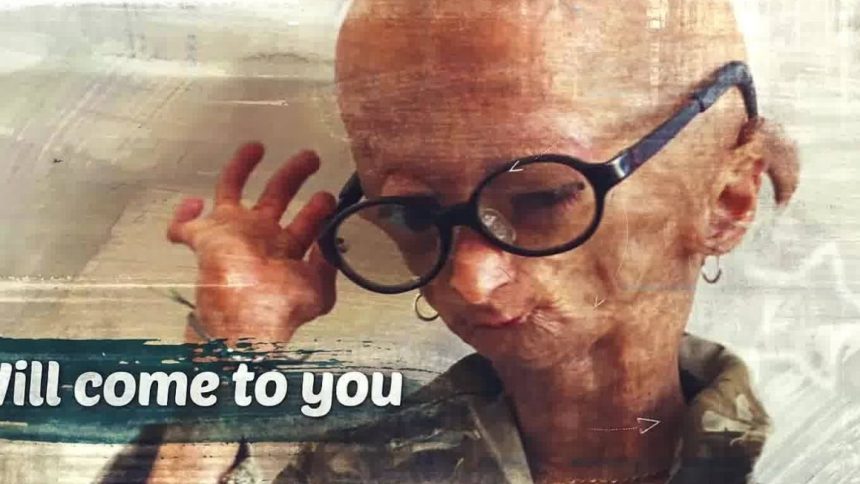 Chi è Adalia Rose Chi è Adalia Rose