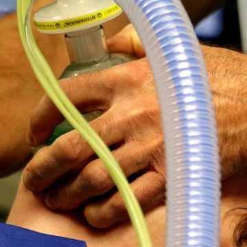 covid il peggior malato