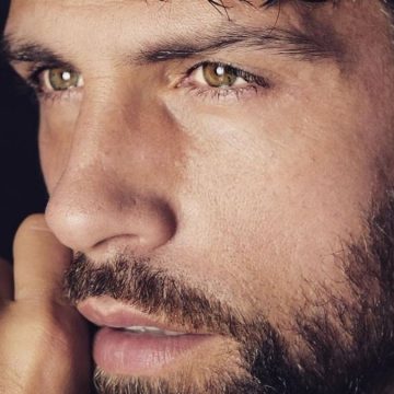 Gilles Rocca, occhio nero: paura su Instagram – FOTO