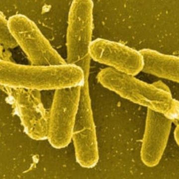 Salmonellosi Salmonellosi