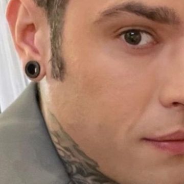 Fedez visita di controllo ospedale