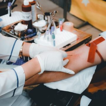 Vaiolo delle scimmie donazioni sangue isolamento