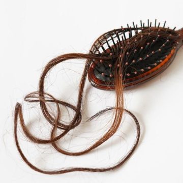 Alopecia nuovo farmaco capelli Alopecia nuovo farmaco capelli