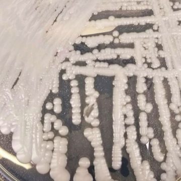 Candida auris cos'è