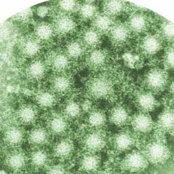 Epatite delta, una rivoluzione terapeutica per una delle malattie più gravi. Scarica il documento