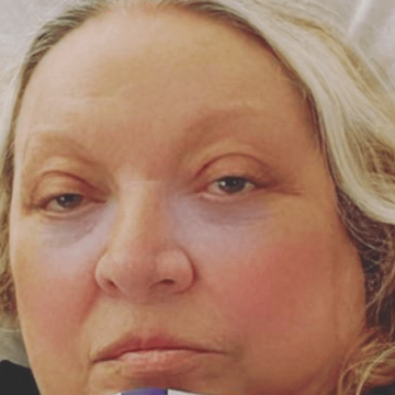 Maria Giovanna Maglie ricoverata Maria Giovanna Maglie ricoverata