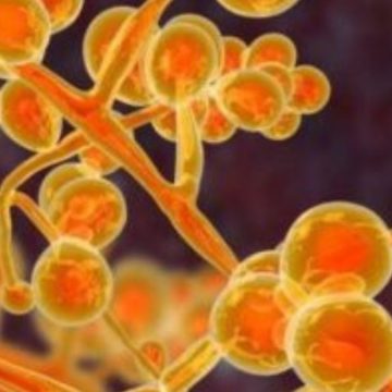 Candida Auris