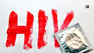 Hiv