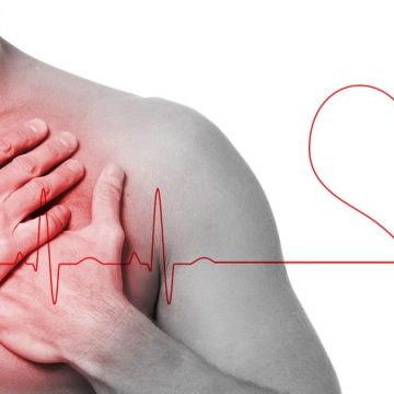 Pazienti ad alto rischio cardiovascolare: semplificare accesso agli inibitori PCSK9i
