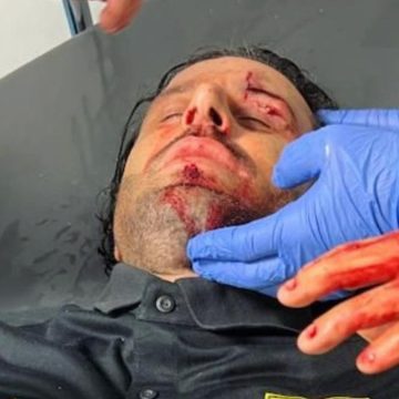 Fabio Grosso