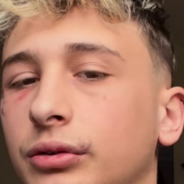 George Ciupilan aggredito picchiato